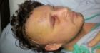 Man suffering aneurysm turned away from clinic over $50 bill